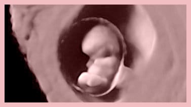 La ecografía en el embarazo